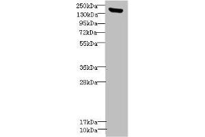 Western blot All lanes: CNTNAP1antibody IgG at 1. (CNTNAP1 anticorps  (AA 20-300))