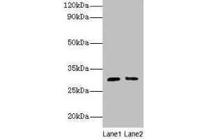 Western blot All lanes: Cd82 antibody at 2 μg/mL Lane 1: Jurkat whole cell lysate Lane 2: A549 whole cell lysate Secondary Goat polyclonal to rabbit IgG at 1/10000 dilution Predicted band size: 30 kDa Observed band size: 30 kDa (CD82 anticorps  (AA 111-227))