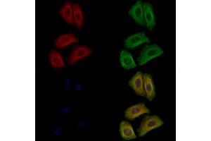 ABIN7094074 and ABIN7098118 staining Hela cells by IF/ICC. (ARL4C anticorps  (C-Term))