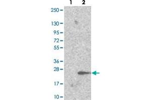 Western blot analysis of Lane 1: Negative control (vector only transfected HEK293T lysate). (TRAPPC6A anticorps)