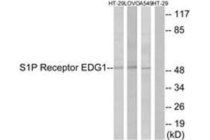 Western blot analysis of extracts from HT-29/LOVO/A549 cells, using S1P Receptor EDG1 (Ab-236) Antibody.