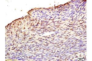 Formalin-fixed and paraffin embedded rat uterus labeled with Anti MAFbx/Fbx32 Polyclonal Antibody, Unconjugated (bs2591R) at 1:200 followed by conjugation to the secondary antibody and DAB staining. (FBXO32 anticorps  (AA 31-130))