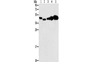 Gel: 10 % SDS-PAGE, Lysate: 40 μg, Lane 1-5: Hela cells, Raji cells, Jurkat cells, A549 cells, NIH/3T3 cells, Primary antibody: ABIN7130674(PPAT Antibody) at dilution 1/250, Secondary antibody: Goat anti rabbit IgG at 1/8000 dilution, Exposure time: 20 seconds (PPAT anticorps)