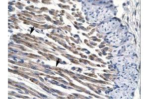 anti-Jumonji Domain Containing 8 (JMJD8) (AA 111-160) antibody
