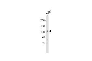Western blot analysis of lysate from A431 cell line, using COL6A1 Antibody at 1:1000. (COL6A1 anticorps  (C-Term))
