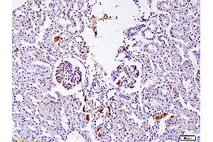 Formalin-fixed and paraffin embedded rat nephroblastoma labeled with Anti SET Polyclonal Antibody, Unconjugated (ABIN760166) at 1:200 followed by conjugation to the secondary antibody and DAB staining (SET/TAF-I anticorps)