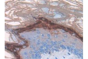 Detection of TNFa in Mouse Esophagus Tissue using Monoclonal Antibody to Tumor Necrosis Factor Alpha (TNFa)