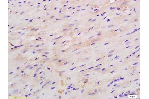 Formalin-fixed and paraffin embedded mouse heart labeled with Rabbit Anti H Cadherin/T cadherin Polyclonal Antibody, Unconjugated (ABIN715271) at 1:200 followed by conjugation to the secondary antibody and DAB staining (Cadherin 13 anticorps  (AA 301-400))