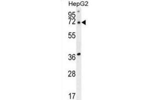 Western Blotting (WB) image for anti-Acyl-CoA Thioesterase 11 (ACOT11) antibody (ABIN2995532) (ACOT11 anticorps)