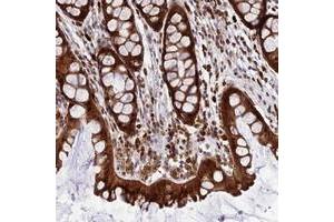 Immunohistochemical staining of human colon with JSRP1 polyclonal antibody  shows strong cytoplasmic and nuclear positivity in glandular cells. (JSRP1 anticorps)