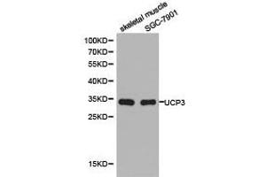 Western Blotting (WB) image for anti-Uncoupling Protein 3 (Mitochondrial, Proton Carrier) (UCP3) antibody (ABIN1875270) (UCP3 anticorps)