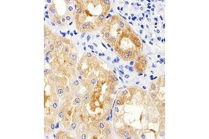 Immunohistochemical analysis of paraffin-embedded H. (MAD2L2 anticorps  (C-Term))