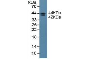 Mouse Detection antibody from the kit in WB with Positive Control: Sample A431 cell lysate.