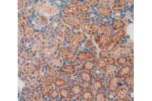 IHC-P analysis of kidney tissue, with DAB staining. (LIFR anticorps  (AA 152-291))
