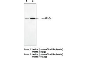Image no. 1 for anti-Cannabinoid Receptor 2 (CNR2) (AA 20-33) antibody (ABIN1491167) (CNR2 anticorps  (AA 20-33))