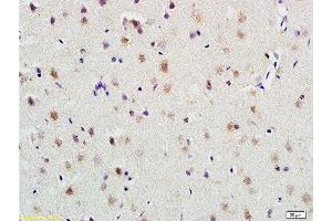 Formalin-fixed and paraffin embedded rat brain labeled with Anti-PLAUR Polyclonal Antibody, Unconjugated  at 1:200 followed by conjugation to the secondary antibody and DAB staining
