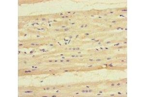 Immunohistochemistry of paraffin-embedded human heart tissue using ABIN7157751 at dilution of 1:100 (KYNU anticorps  (AA 99-214))
