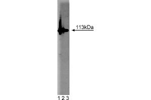 Western Blotting (WB) image for anti-Poly (ADP-Ribose) Polymerase 1 (PARP1) (AA 22-219) antibody (ABIN968333)