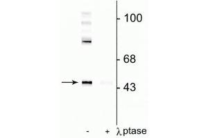 Western blot of rat cortical lysate showing specific immunolabeling of the ~50 kDa Gap-43 protein phosphorylated at Ser41 in the first lane (-). (GAP43 anticorps  (pSer41))