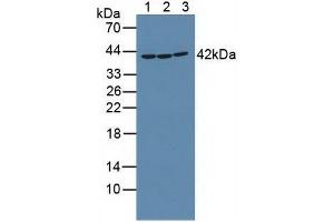 Figure. (RIPK2 anticorps  (AA 432-540))