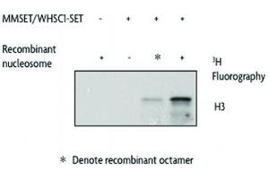 MMSET / WHSC1 - SET activity assay using Recombinant Nucleosomes as substrates. (WHSC1 Protein (AA 942-1240) (GST tag))