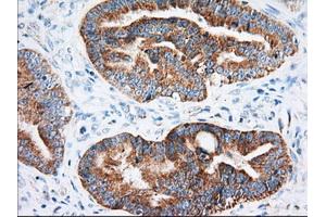 Immunohistochemical staining of paraffin-embedded Human Kidney tissue using anti-IGF2BP2 mouse monoclonal antibody. (IGF2BP2 anticorps)
