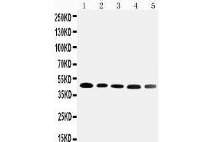 Anti-Cortisol Binding Globulin antibody, Western blotting Lane 1: HELA Cell Lysate Lane 2: A431 Cell Lysate Lane 3: U87 Cell Lysate Lane 4: 22RV1 Cell Lysate Lane 5: PANC Cell Lysate (SERPINA6 anticorps  (N-Term))