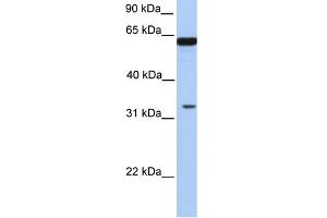 WB Suggested Anti-PERLD1 Antibody Titration:  0. (PGAP3 anticorps  (N-Term))