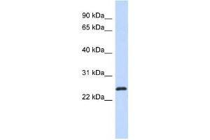 Western Blotting (WB) image for anti-Kruppel-Like Factor 16 (KLF16) antibody (ABIN2457888) (KLF16 anticorps)