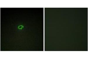 Immunofluorescence analysis of COS7 cells, using Collagen IV alpha4 Antibody. (Col4a4 anticorps  (AA 541-590))
