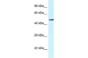Western Blot showing VNN2 antibody used at a concentration of 1 ug/ml against Fetal Kidney Lysate