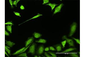 Immunofluorescence of purified MaxPab antibody to HADH on HeLa cell. (HADH anticorps  (AA 1-314))