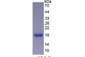 SDS-PAGE of Protein Standard from the Kit  (Highly purified E.