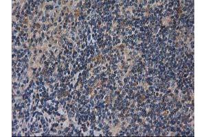 Image no. 2 for anti-Destrin (Actin Depolymerizing Factor) (DSTN) antibody (ABIN1497910) (Destrin anticorps)