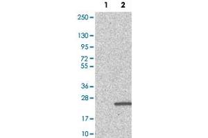 Western Blot analysis of Lane 1: negative control (vector only transfected HEK293T cell lysate) and Lane 2: over-expression lysate (co-expressed with a C-terminal myc-DDK tag in mammalian HEK293T cells) with PFDN4 polyclonal antibody . (PFDN4 anticorps)