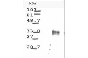 Image no. 1 for anti-Cyclin D1 (CCND1) antibody (ABIN221149) (Cyclin D1 anticorps)