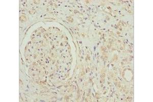 Immunohistochemistry of paraffin-embedded human kidney tissue using ABIN7154750 at dilution of 1:100 (GNB1L anticorps  (AA 1-327))