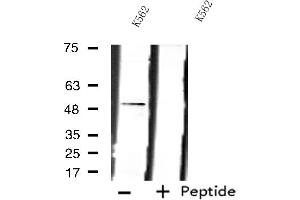 Western blot analysis of extracts from K562 cells using LPCAT2 antibody. (LPCAT2 anticorps  (N-Term))