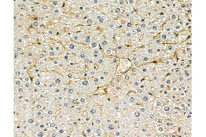 ABIN7096903 and ABIN7100969 at 1/100 staining mouse liver tissue by IHC-P. (DOLPP1 anticorps)