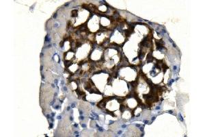 IHC analysis of SYP using anti-SYP antibody (ABIN7603120). (Synaptophysin anticorps  (N-Term))