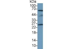 Detection of PRDX6 in Rat Lung lysate using Polyclonal Antibody to Peroxiredoxin 6 (PRDX6)