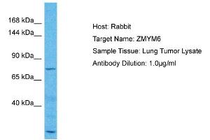 Host: Rabbit Target Name: ZMYM6 Sample Type: Lung Tumor lysates Antibody Dilution: 1. (ZMYM6 anticorps  (N-Term))