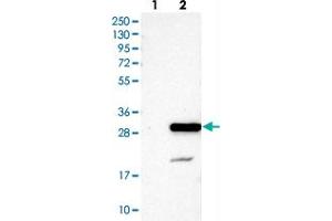 Western blot analysis of Lane 1: Negative control (vector only transfected HEK293T lysate), Lane 2: Over-expression Lysate (Co-expressed with a C-terminal myc-DDK tag (~3. (NXT2 anticorps)