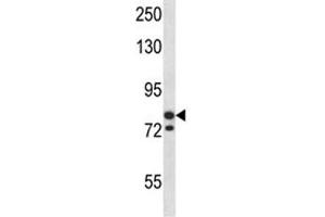 MCM3 antibody western blot analysis in SK-BR-3 lysate. (MCM3 anticorps  (AA 36-64))