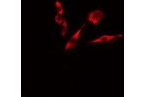 ABIN6276637 staining  HeLa cells by IF/ICC. (TNFSF13 anticorps  (Internal Region))
