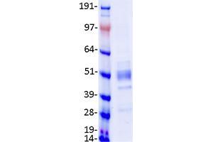 Validation with Western Blot