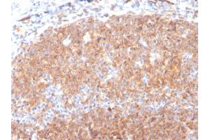 Formalin-fixed, paraffin-embedded human Tonsil stained with CD19 Monospecific Mouse Monoclonal Antibody (CD19/3117).