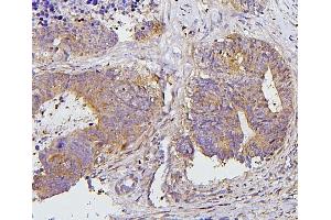 IHC analysis of PRKCD using anti-PRKCD antibody (ABIN7601631).
