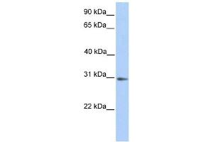 ABHD13 antibody used at 1 ug/ml to detect target protein. (ABHD13 anticorps  (N-Term))