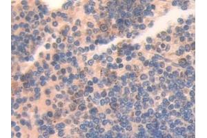 Detection of ATF7 in Mouse Spleen Tissue using Polyclonal Antibody to Activating Transcription Factor 7 (ATF7)